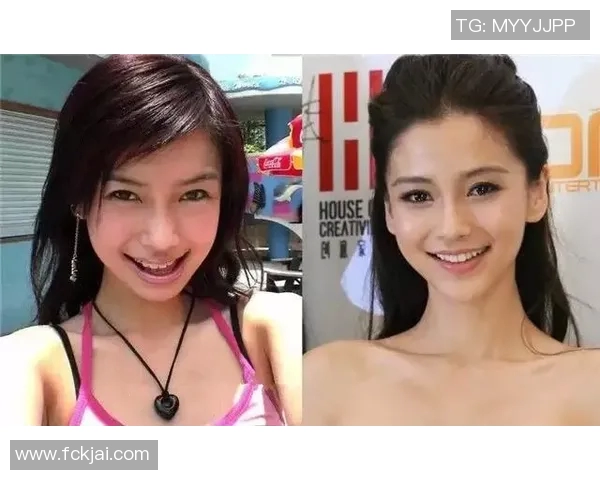 戴过牙套的足球明星们如何在赛场上展现自信与魅力 戴过牙套的足球明星们如何在赛场上展现自信与魅力